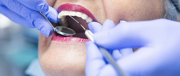 Best Urgent Care for Lost Fillings or Crowns in Edgewood, WA